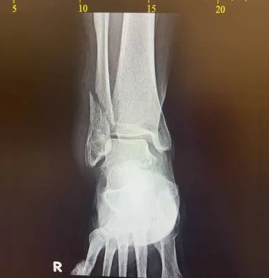 pro 6