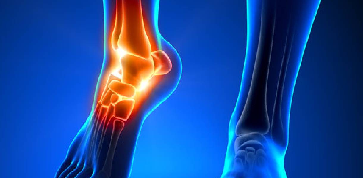 Dr. Haytham Elkhatib - Best Orthopaedic Doctor in Dubai